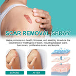 ScarRemove+ Advanced Spray Fade Scars